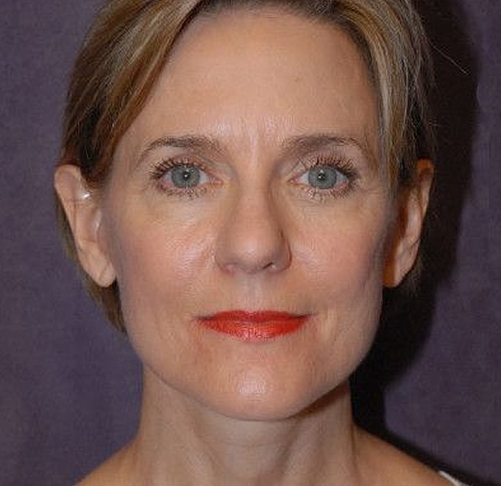 Woman with light makeup and red lipstick.