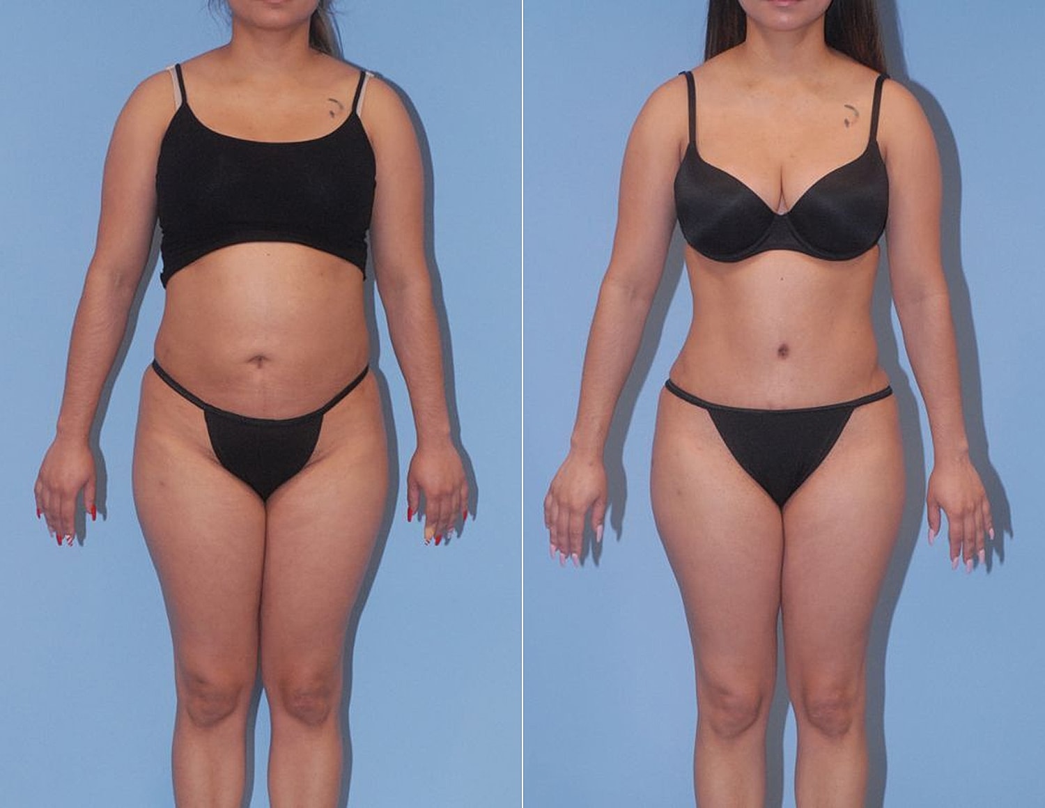 Body transformation before and after comparison.