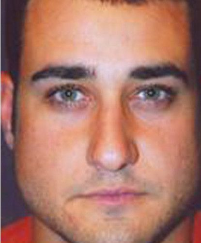 Male Facial Rejuvenation Before & After