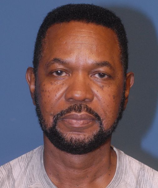 Male Facial Rejuvenation Before & After