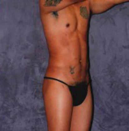 Male Body Contouring Before & After