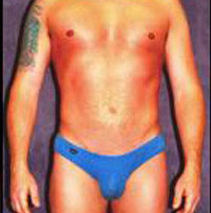 Male Body Contouring Before & After